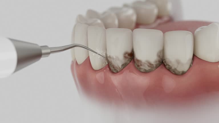 Trusted Dental Implants service in Barnesville, OH - Dentist Open Now